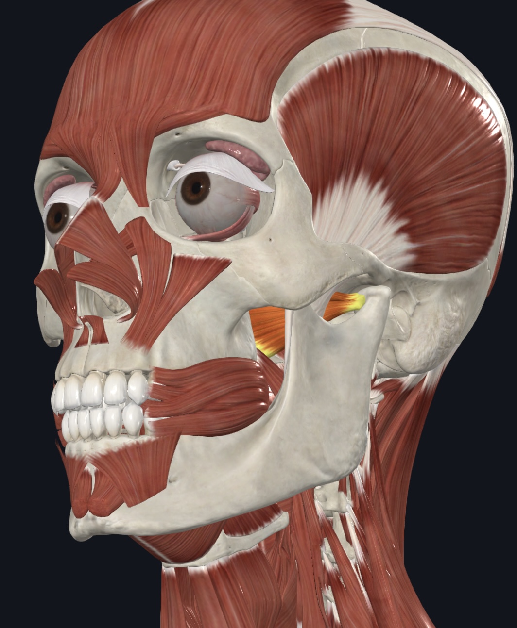 term image