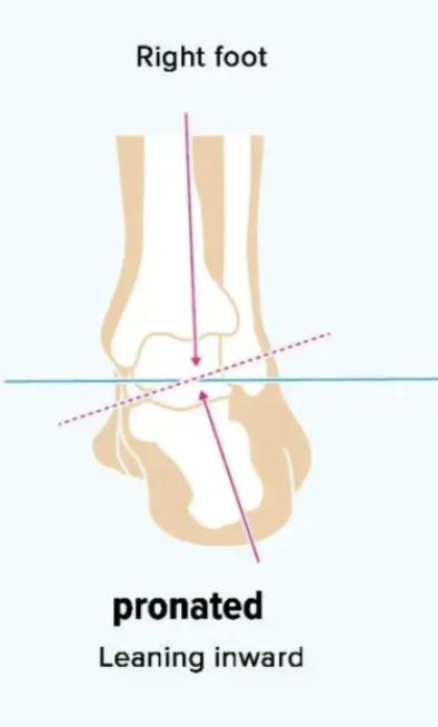 <p>leaning inwards </p>