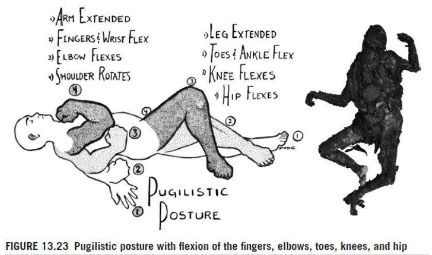 <p>normal burning patterns of body</p>