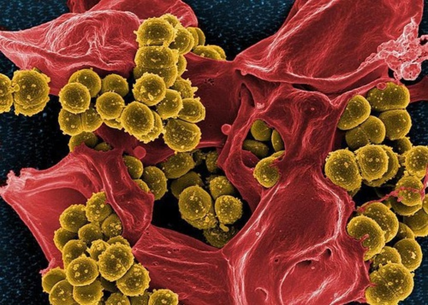 <p>Single-celled organisms without a nucleus.</p>
