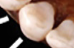 <p>canines</p>