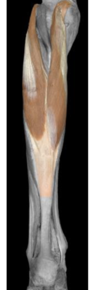 <p>gastrocnemius medial head</p>