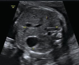 <p><span style="line-height: 21.6px;"><strong>Evaluate fetal situs</strong>; what is the presentation of the image?</span></p>