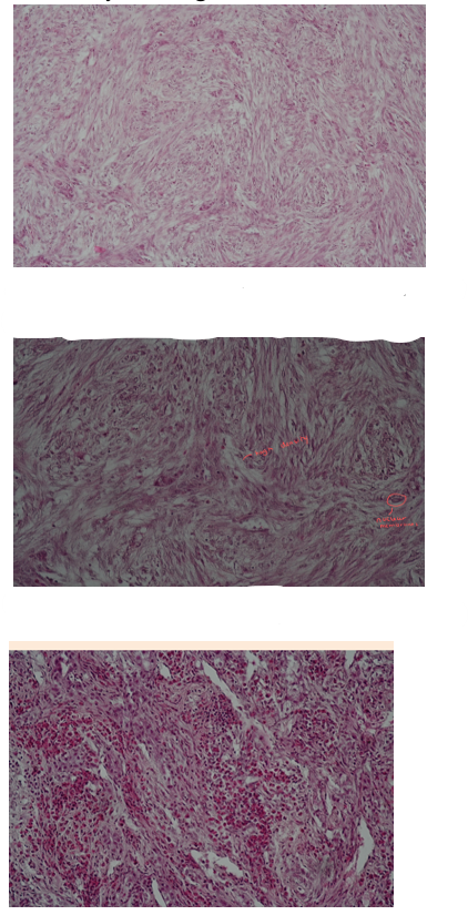 <p>This is?</p><img src="https://knowt-user-attachments.s3.amazonaws.com/941378aa-035e-4ba6-a499-2d2c18ff8d9a.png" data-width="50%" data-align="center"><p></p>