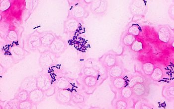 <p>What am i- gram stain, shape, arrangement</p>