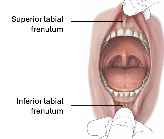 <ul><li><p>External border: lips and cheeks</p></li><li><p>Internal border: teeth and gingiva</p></li></ul><p></p><p><u>Labial frenulum</u>:</p><ul><li><p>Tissue that connects the lips and gingiva (gums)</p></li></ul><p></p>