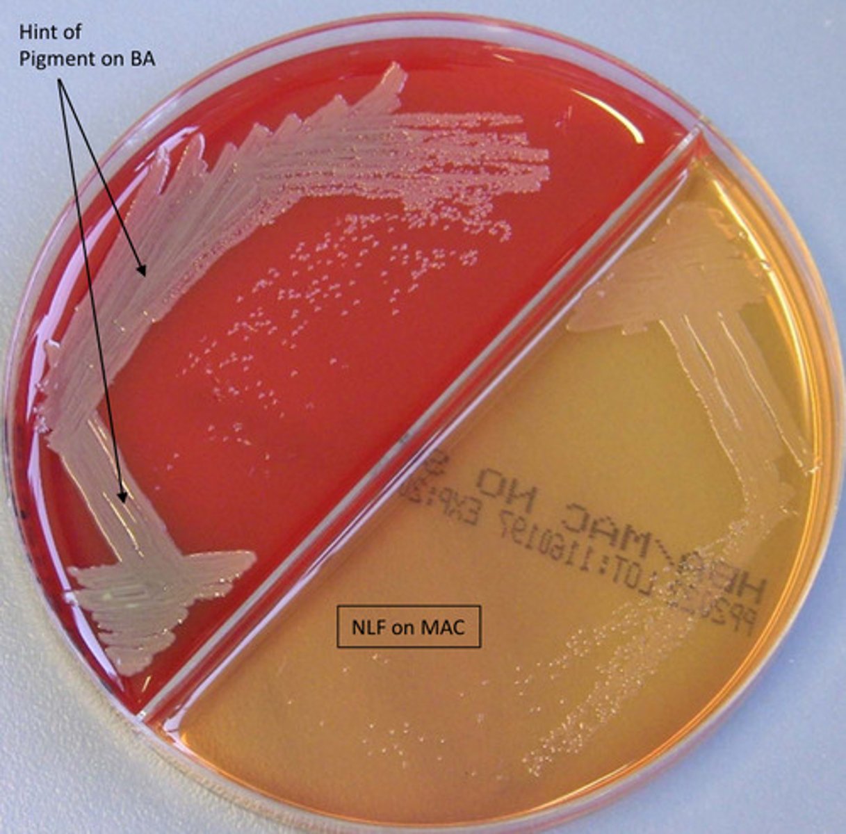<p>GNB, oxidase neg, motile, spot indole neg, resistant to antimicrobials</p>