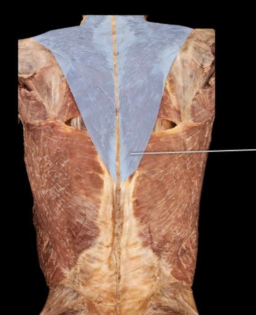 <p>What muscle is this?</p>