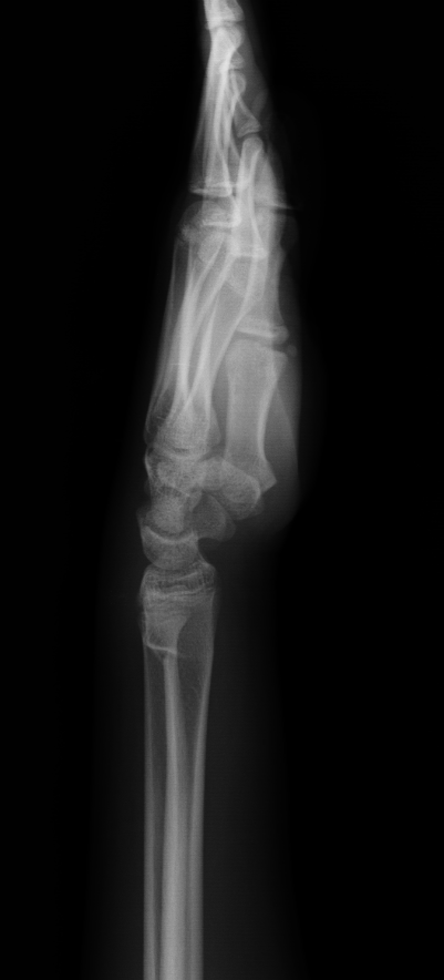 <p>Describe the abnormality demonstrated.</p>