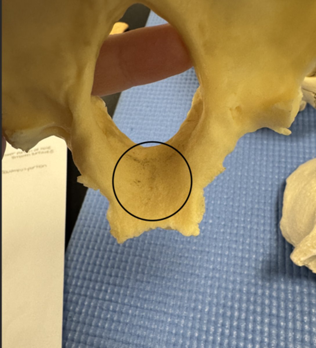 <p>seen inferiorly on the basilar part</p><p>smooth</p>