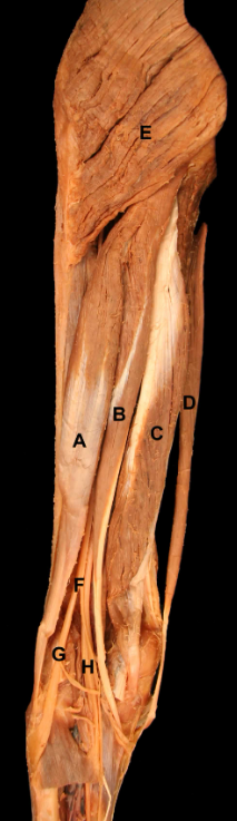 <p>E</p>