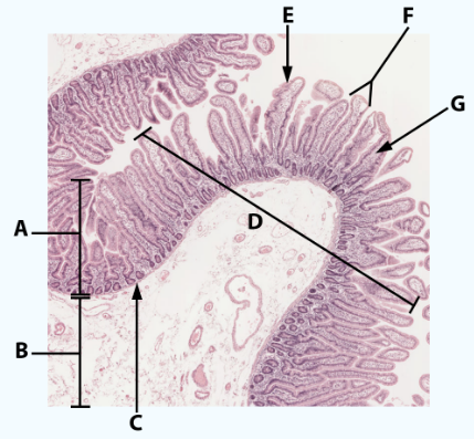 <p>B</p>
