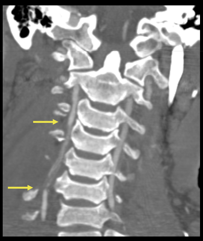 <p><span style="color: blue;"><strong>Que regarde-t-on ?</strong></span></p>