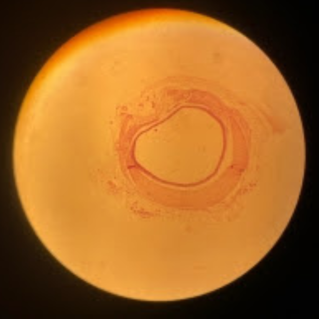 term image