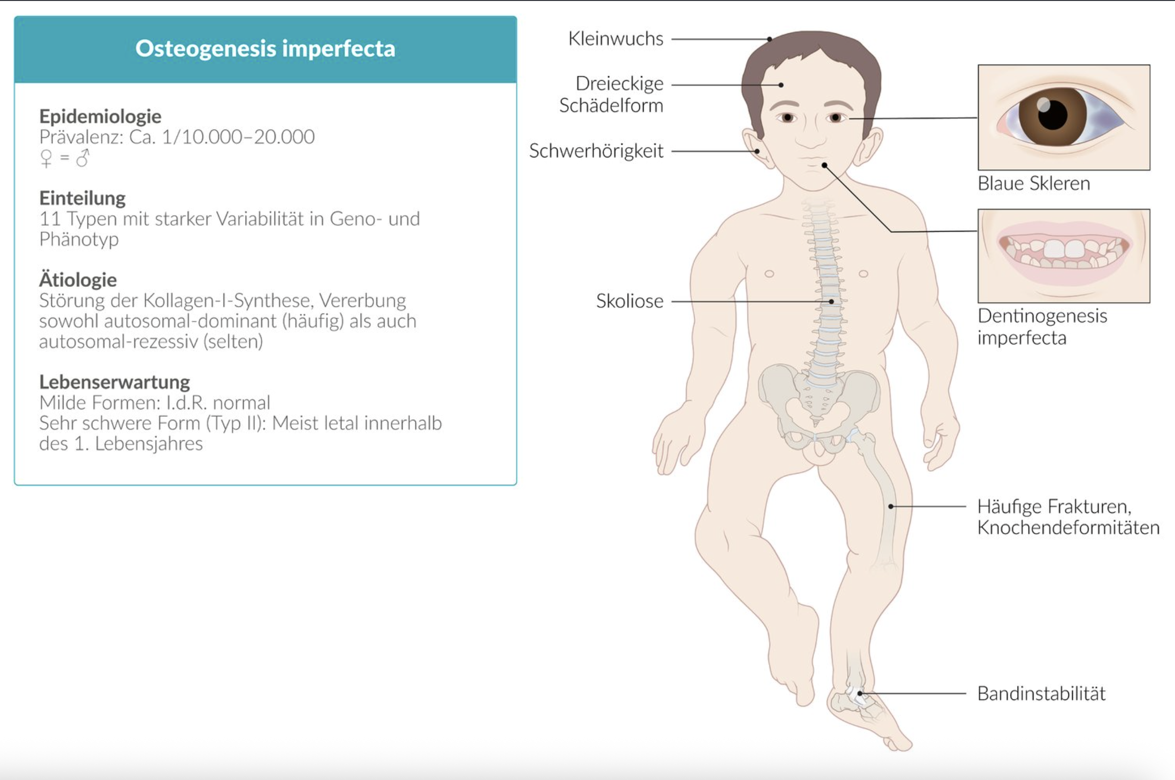 <p>A. Collagen type I</p>