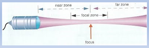 <p>where the beam is focused on each side of the focal point</p>