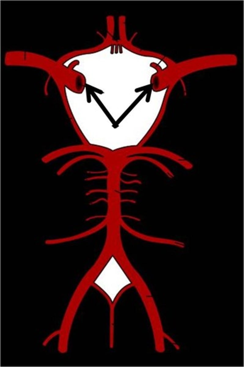 <p>this artery branches off the common carotid arteries, travel up into the skull through the carotid canal, and then divide to form the anterior and middle cerebral arteries. </p>