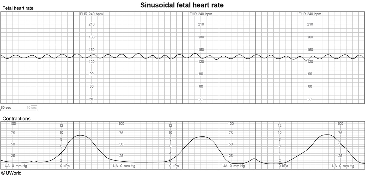 <p>35wks, SROM of bright red fluid. what is it, what category, and what does it likely mean?</p>