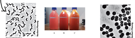 <p><em>They exhibit various forms </em><span style="color: green;"><strong><em>such as rods, cocci, and spirals,</em></strong></span><em> with some being filamentous or forming clusters. </em></p><p>• <strong>Phaesospirillum fulvum</strong></p><p><strong>• Rhodopila globiformis </strong></p>