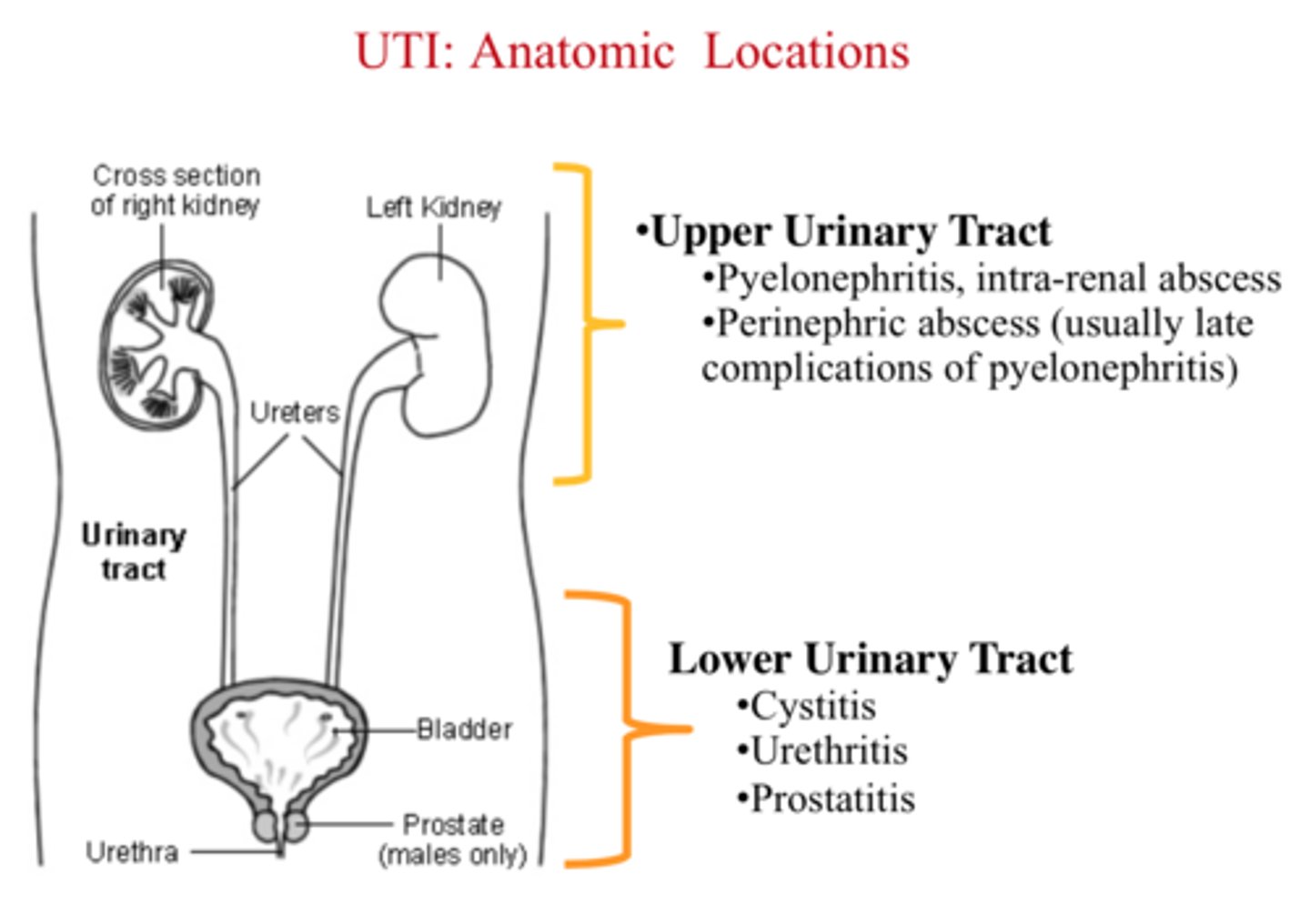 <p>Urinary Tract Infection (UTI)</p>