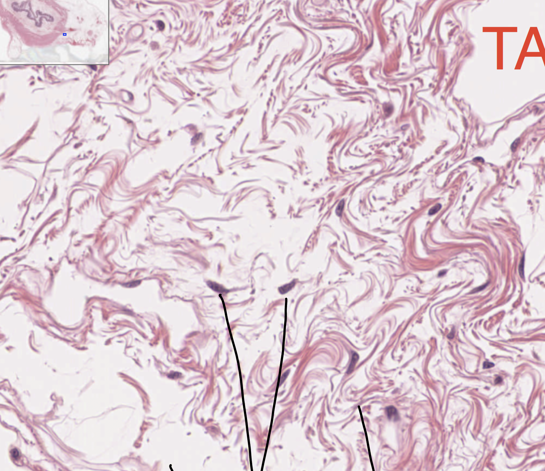 <p>found between many organs, where it acts both to absorb shock and bind tissues together</p>