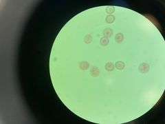 <p>What is the genus species of these tapeworm eggs? Its definitive host is man, and its intermediate host is cattle</p>