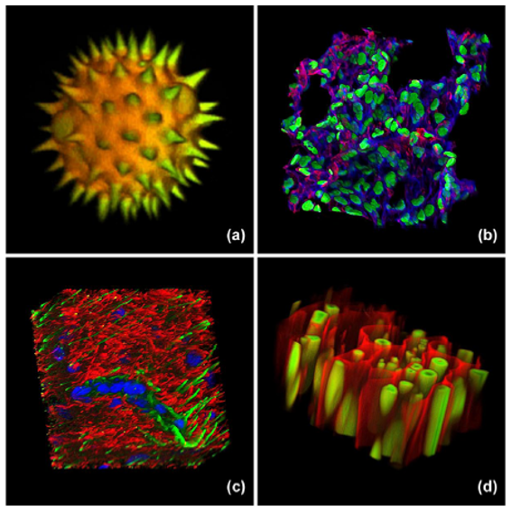 <ul><li><p><span>Image formation is restricted to a well-defined plane.</span></p></li><li><p><span>Confocal optical sectioning technique enables the examination of both living and fixed specimens.</span></p></li><li><p><span>Software packages - optical sections collected to produce 3D images.</span></p></li></ul><p></p>