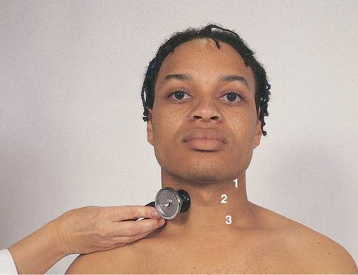 <p>-use the BELL side of stethoscope to hear for BRUITS (these are low pitched sounds)</p><p>-one side at a time</p><p>-have the pt hold their breath as a bruit can be confused with lung sounds</p>