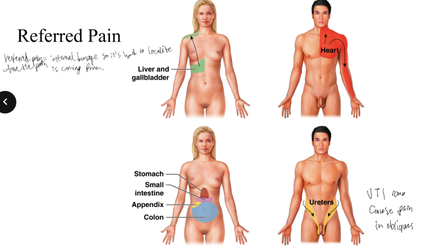 <p>What is referred pain?</p>