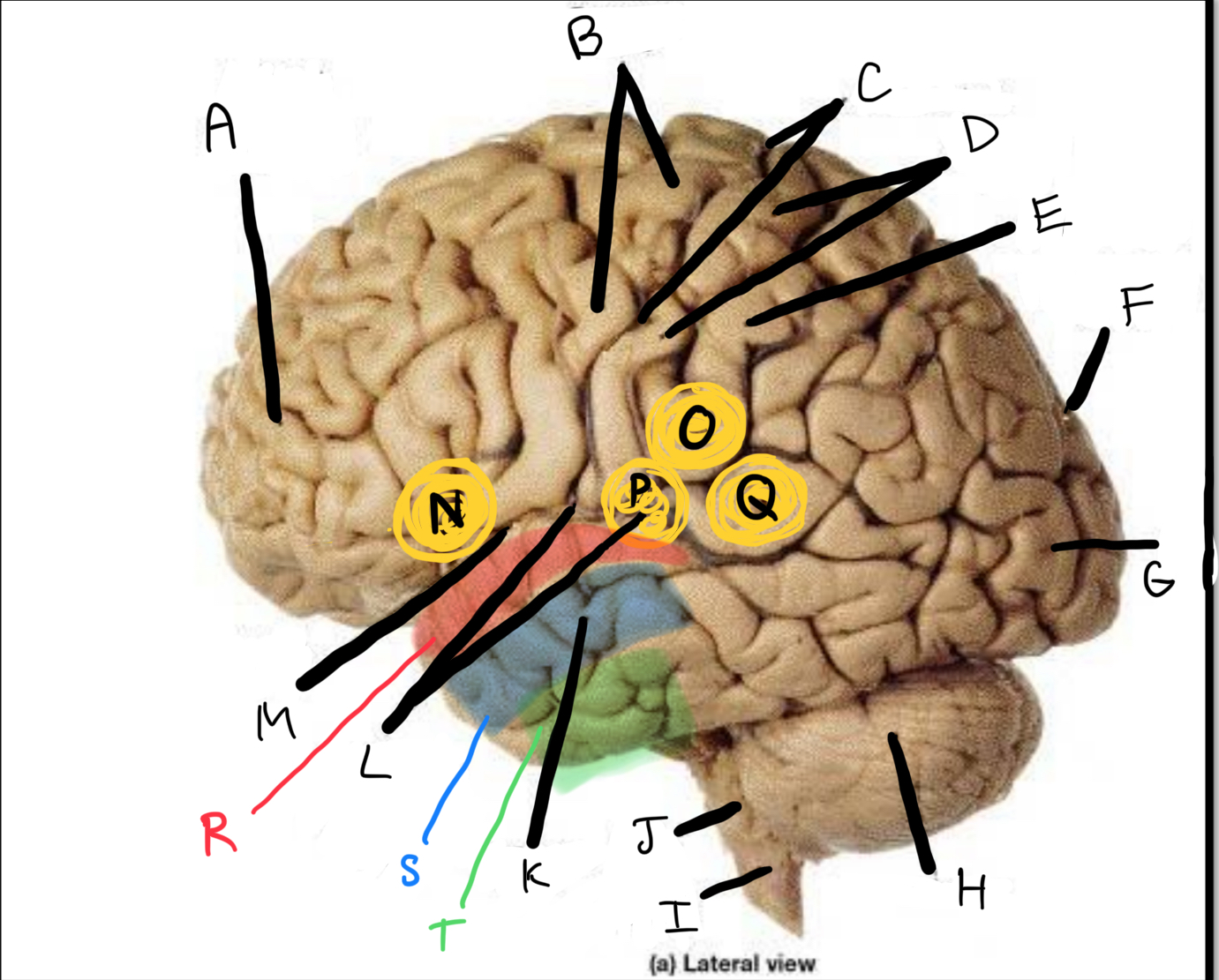 <p>What connects N———P<br>(frontal, temporal and parietal lobes to allow speech coordination that is comprehended)</p>