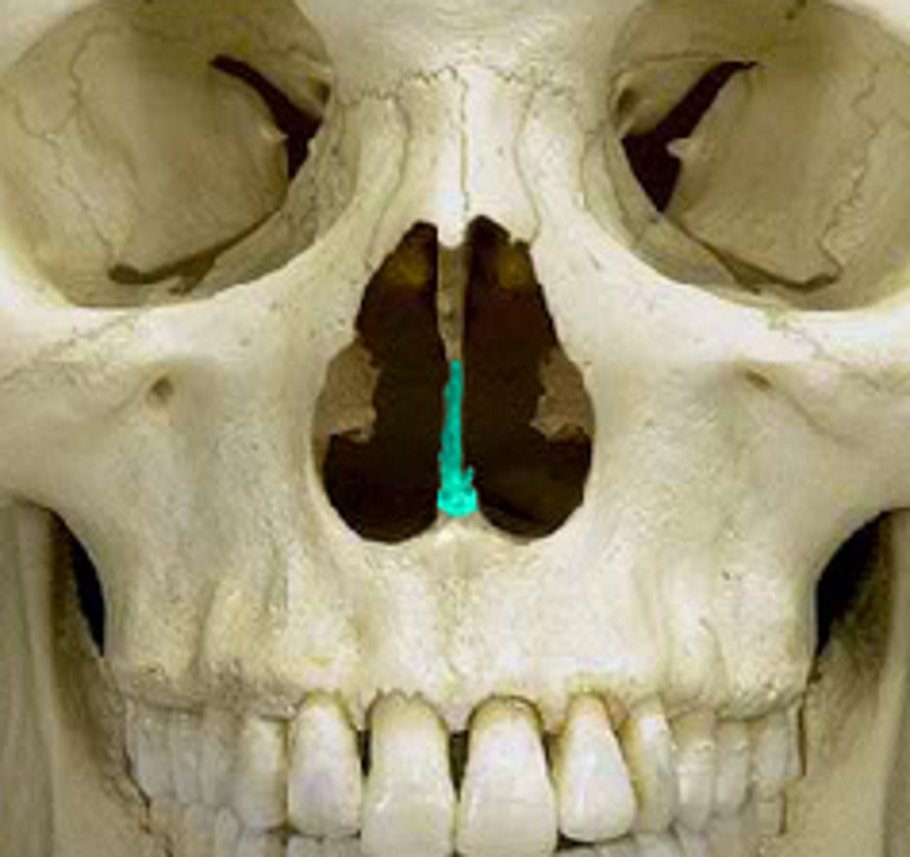 <p>Inferior to Ethmoid</p>