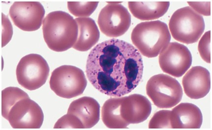 <ul><li><p>account for about 60 percent of the WBC count. </p></li><li><p>They have a nucleus with three to five lobes </p></li><li><p>have phagocytic qualities. </p></li><li><p>They are important in </p><ul><li><p>the destruction of bacteria </p></li><li><p>their numbers increase in the early stage of acute inflammation.</p></li></ul></li></ul><p></p>