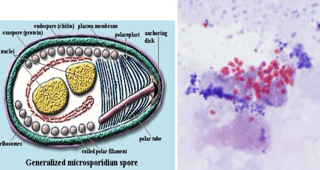 <p>Genus: Enterocytozoon</p>