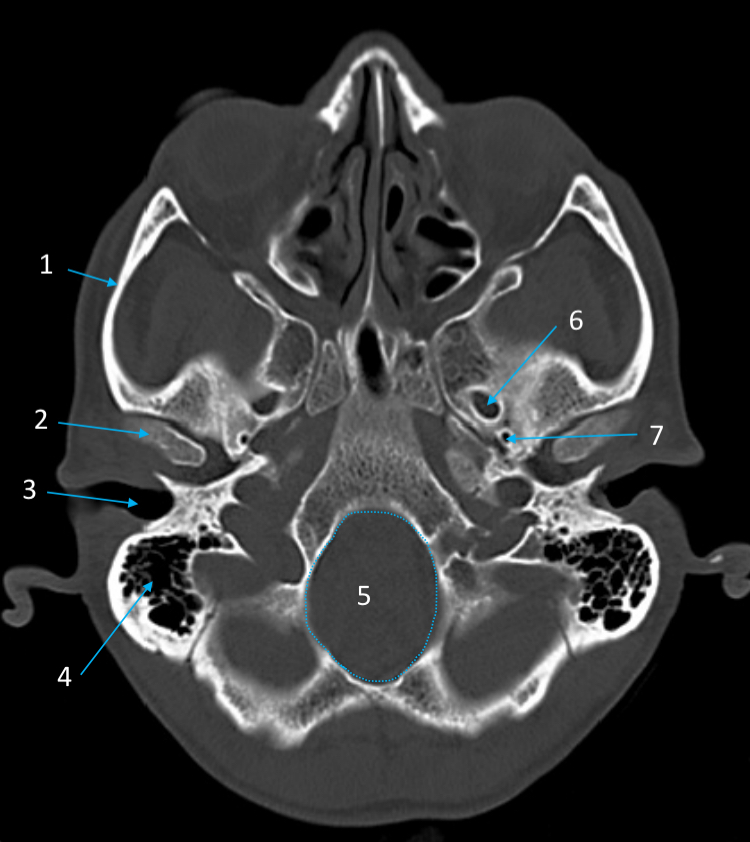 <ol start="4"><li><p>ID structure</p></li></ol><p></p>