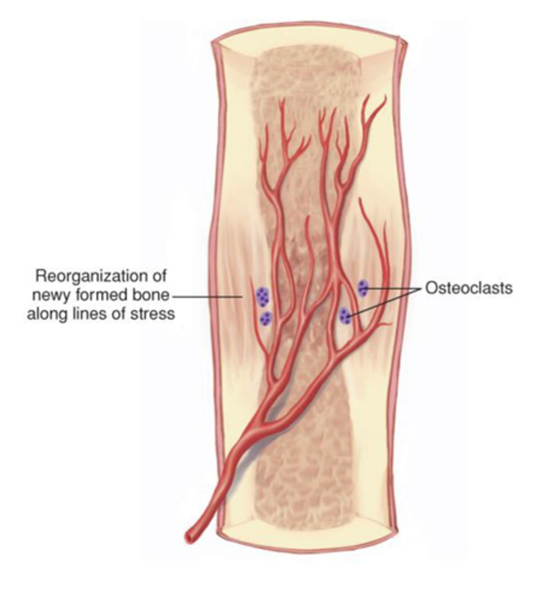<p>Dead bone is removed by osteoclasts</p><p>Compact bone replaces spongy bone</p><p>Excess material is removed and compact bone is laid to reconstruct the shaft</p>