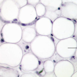<ol><li><p><strong>Name the tissue type</strong></p></li><li><p><strong>Name the cell type</strong></p></li><li><p><strong>Know where it is found in the body</strong></p></li><li><p><strong>What fill’s each bubble?</strong></p></li><li><p><strong>What is in the space between the bubbles?</strong></p></li></ol><p></p>