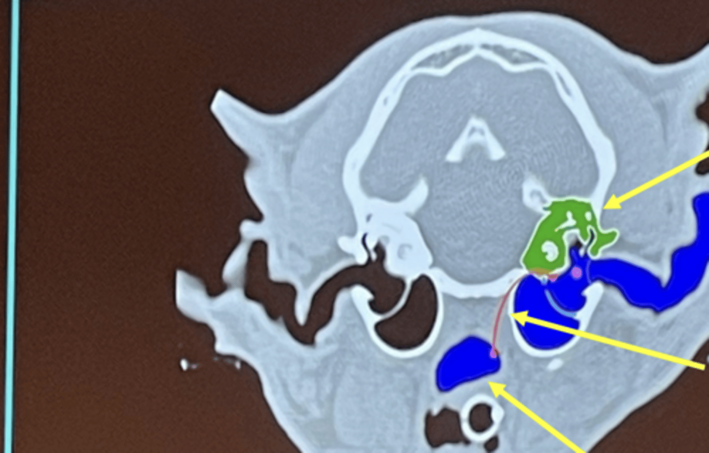 <p>What is the top arrow pointing to (green)?</p>