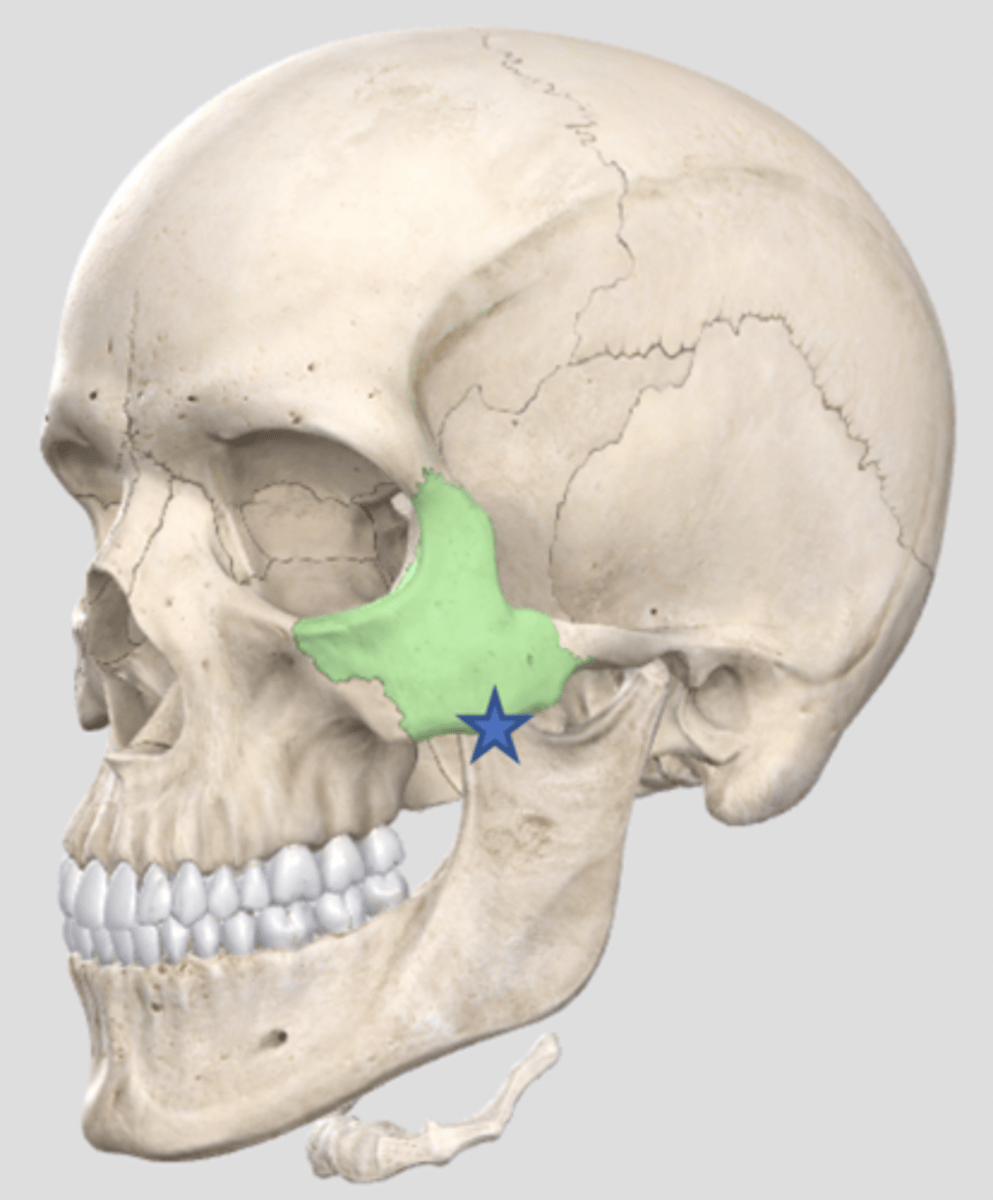 <p>What feature is this on zygomatic?</p>