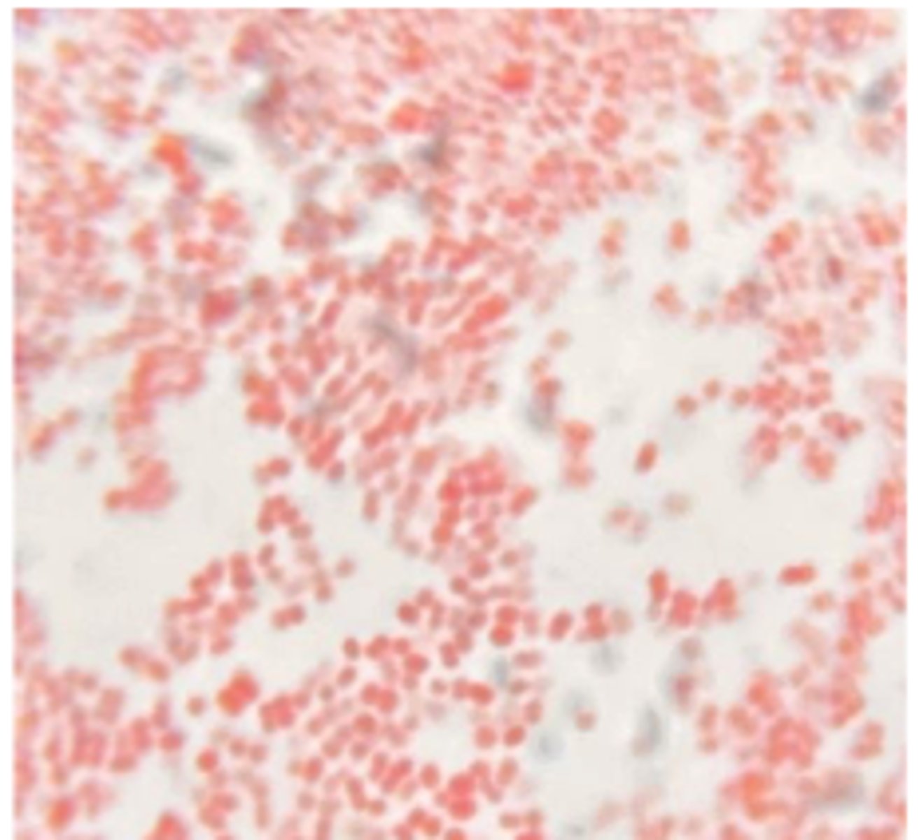 <p>BA &amp; MAC plates were inoculated with swabs from cases of infectious bovine keratoconjunctivitis (IBK)</p><p>Growth on BA (no growth on MAC). Describe the morphologic features on cytology. What is the presumptive diagnosis</p>