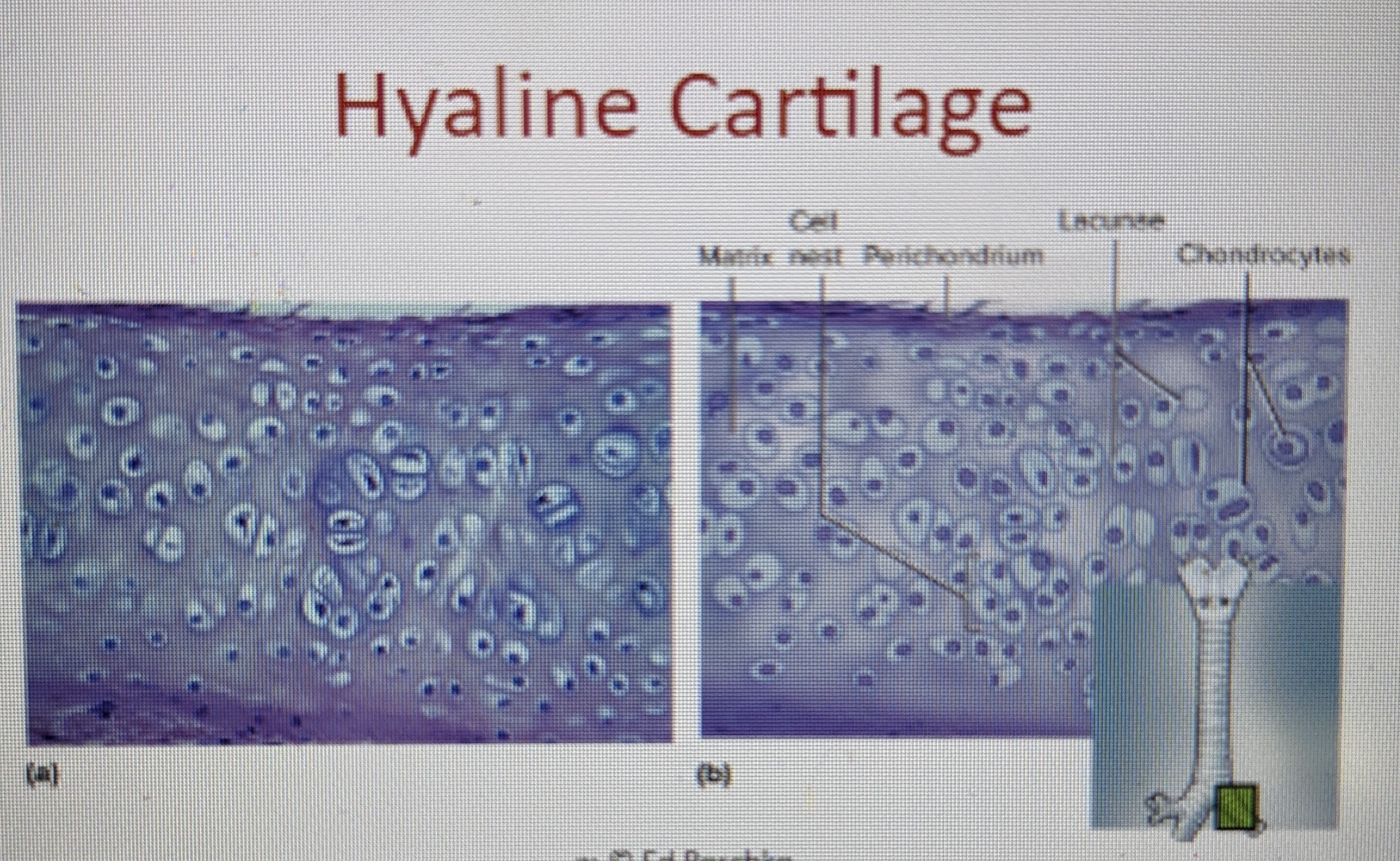 eases joint movement, holds airway open, moves vocal cords, growth of juvenile long bones; kind of structural, kind of slipper 

* has clear, glassy appearance because of fineness of collagen fibers 
* location: articular cartilage, costal cartilage, trachea, larynx, fetal skeleton 
