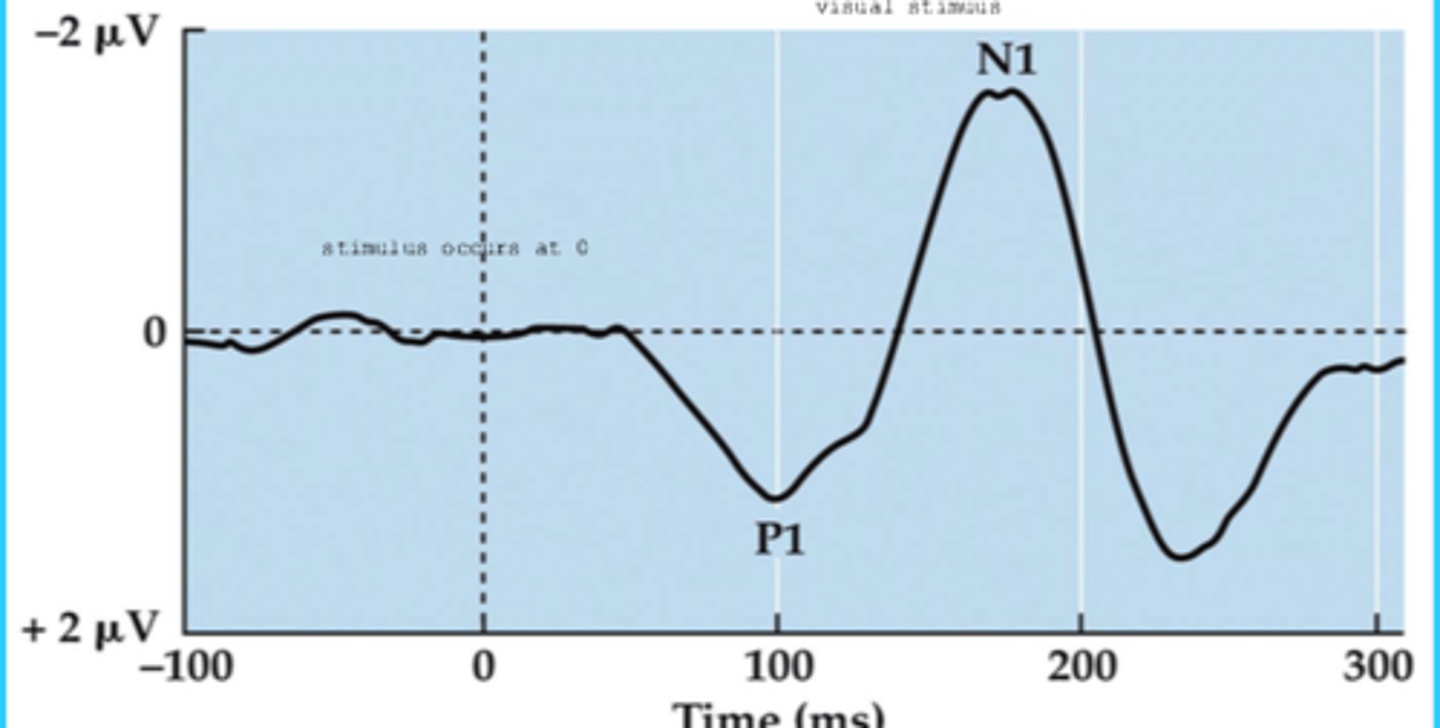 <p>the first neural responses that are observed after a visual stimulus.</p>