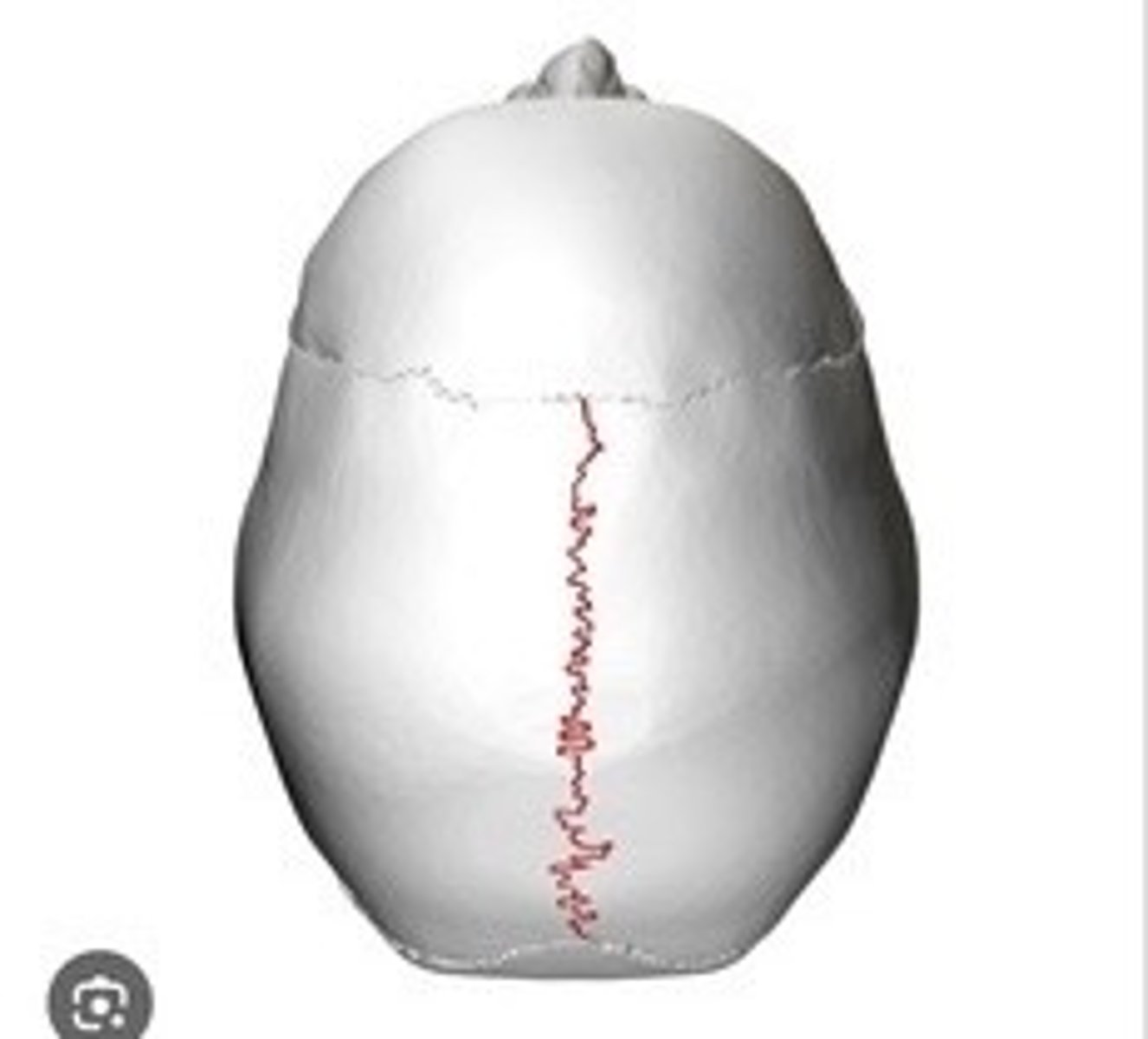 <p>Suture between the two parietal bones.</p>