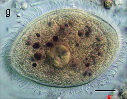 <p>A protozoan parasite that causes Balantidiasis, transmitted through contaminated food/water, resulting in diarrhea.</p>