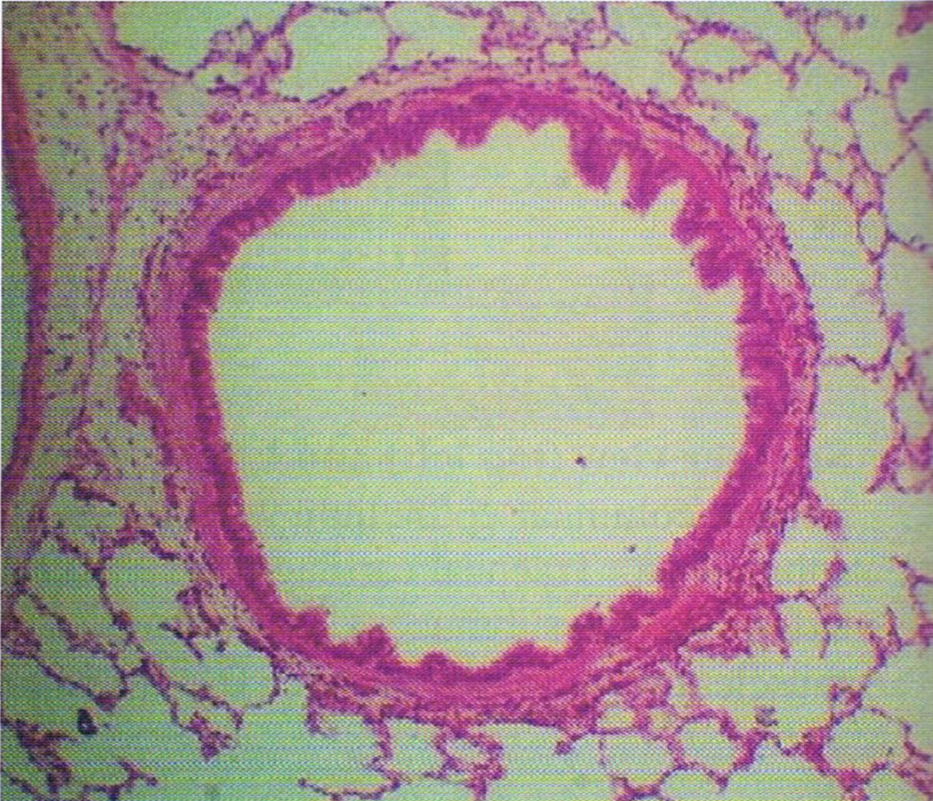 <p>Identify the structure and LE</p>