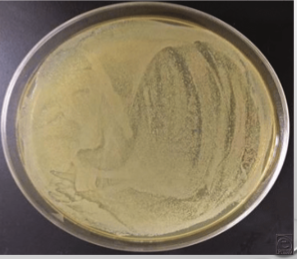 <p>For example: Fecal slurry, raw sewage sample is obtained and a volume of that sample (1 ml) is poured or spread onto an agar plate (subsample/aliquot)</p>