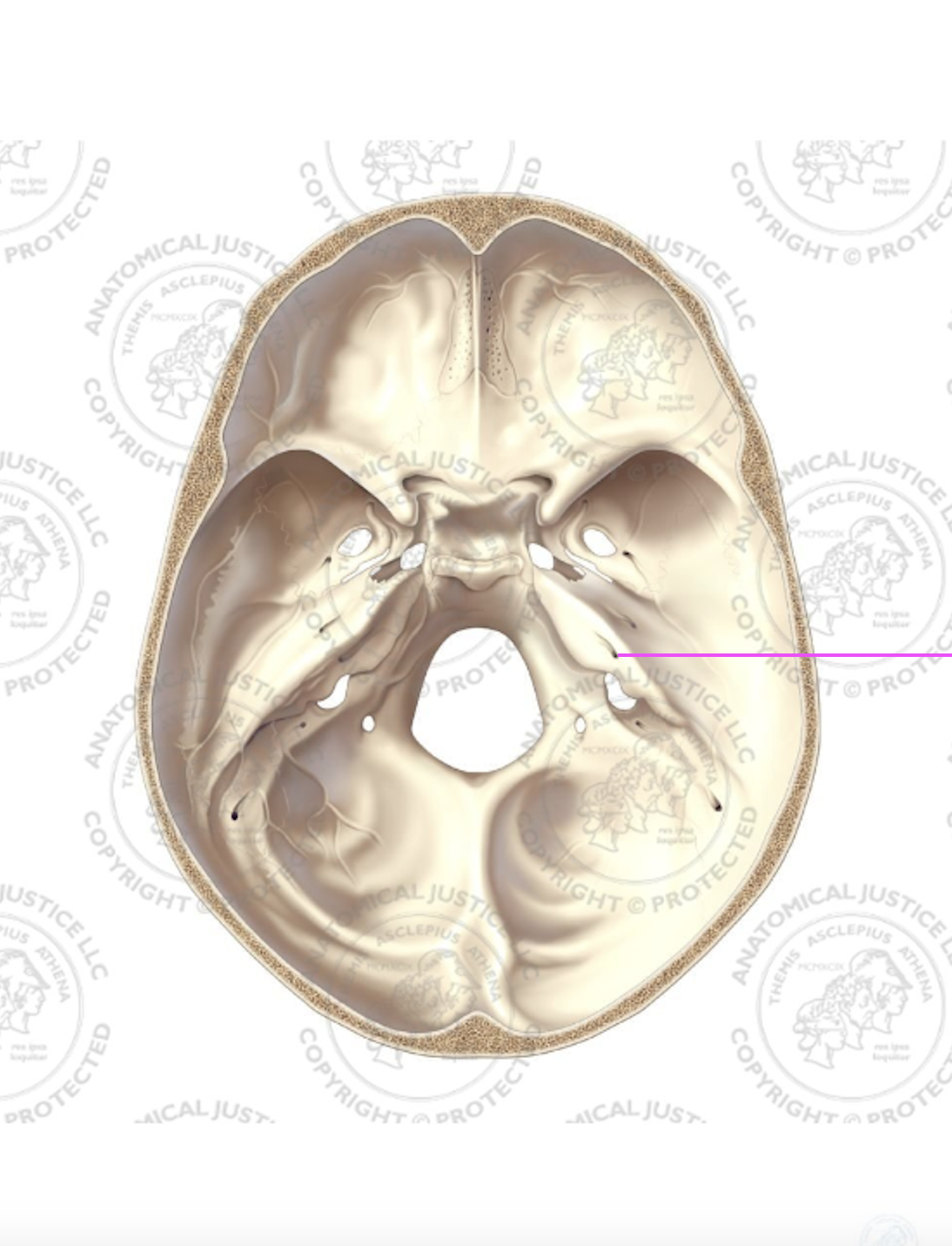 <p>What bone marking is this?</p>