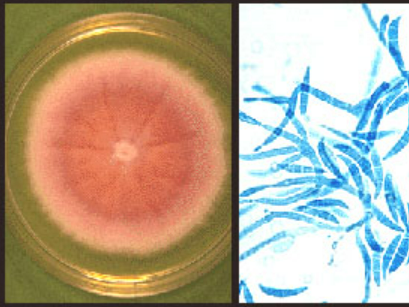 <p>Illustrated in the image is a fungus colony on Sabouraud’s dextrose agar. Note the cottony surface, and pink pigmentation. The lactophenol blue stain is pictured as well. What is the genus identified of this isolate?</p>
