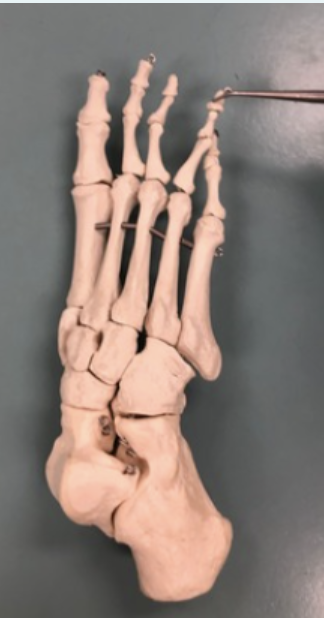 <p><span style="font-family: -apple-system, system-ui, Segoe UI, Roboto, Helvetica Neue, Arial, Noto Sans, Liberation Sans, sans-serif, Apple Color Emoji, Segoe UI Emoji, Segoe UI Symbol, Noto Color Emoji">Identify this bone.&nbsp;</span></p>