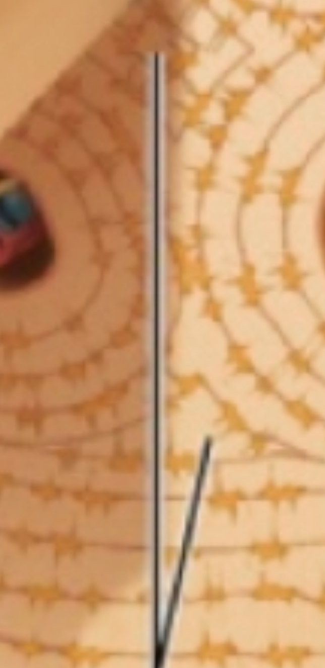 <p>Leftover lamellae filling gaps between osteons.</p>