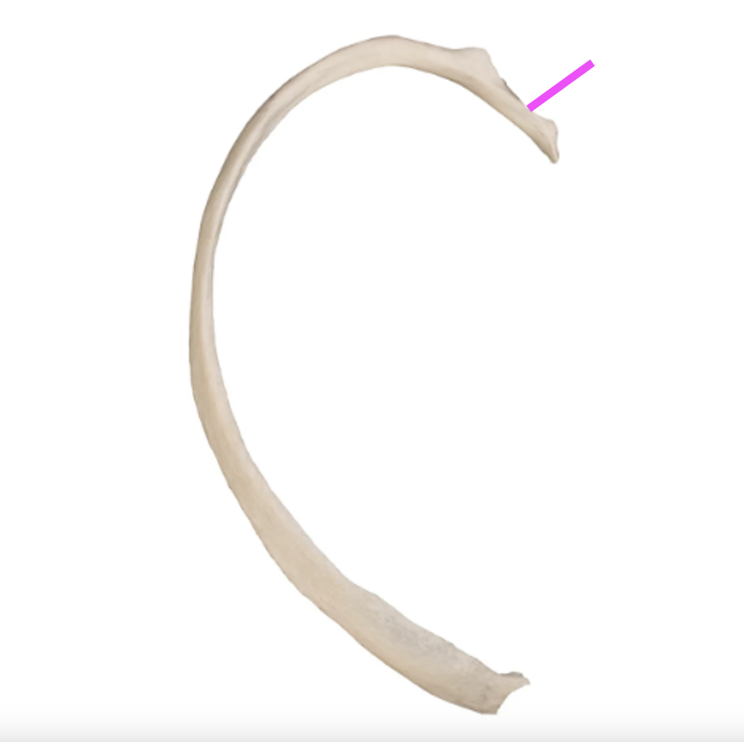 <p>What part of the rib is this?</p>